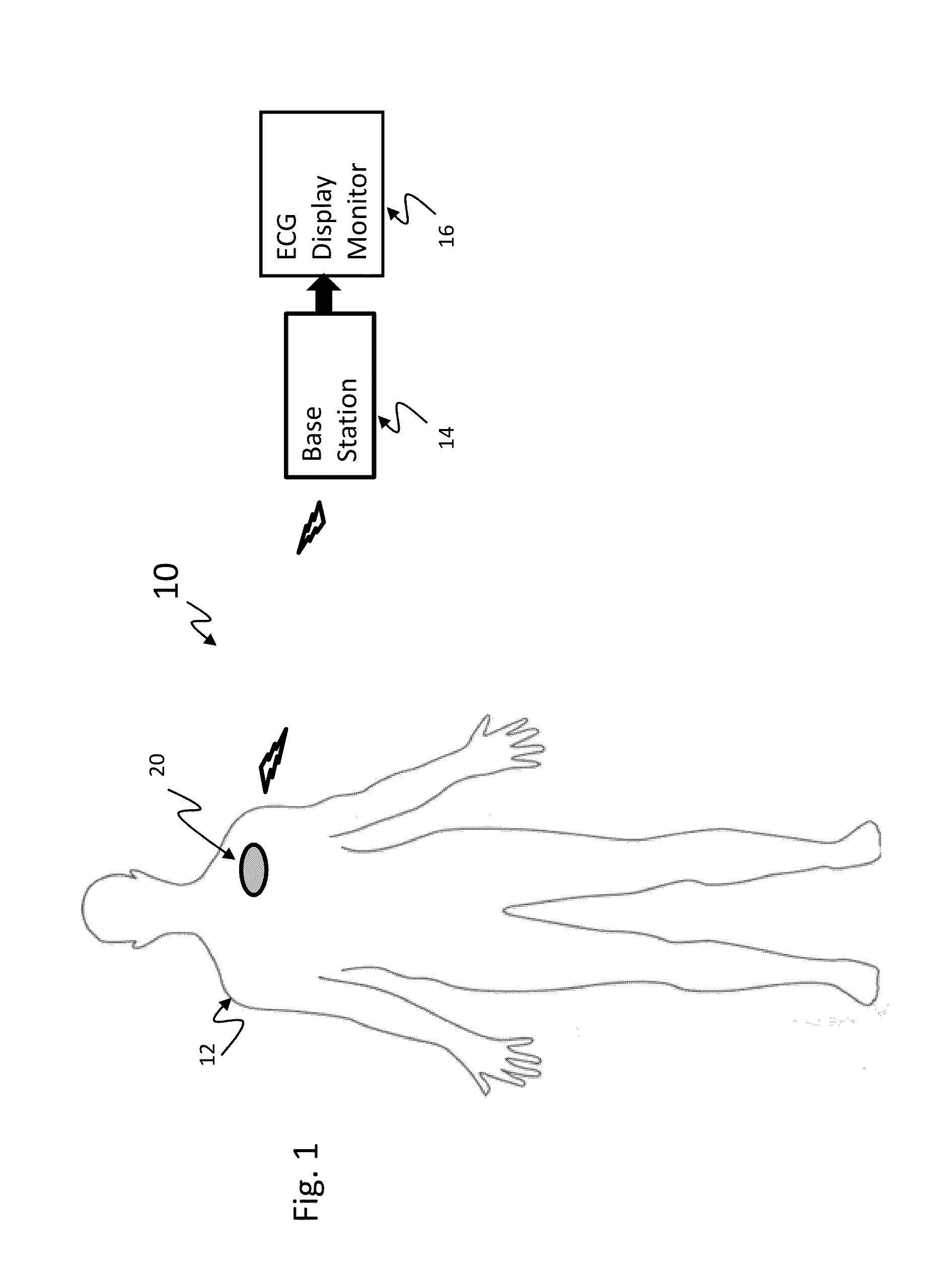 Leadless wireless ECG  measurement system and method for measuring of bio-potential electrical activity of the heart