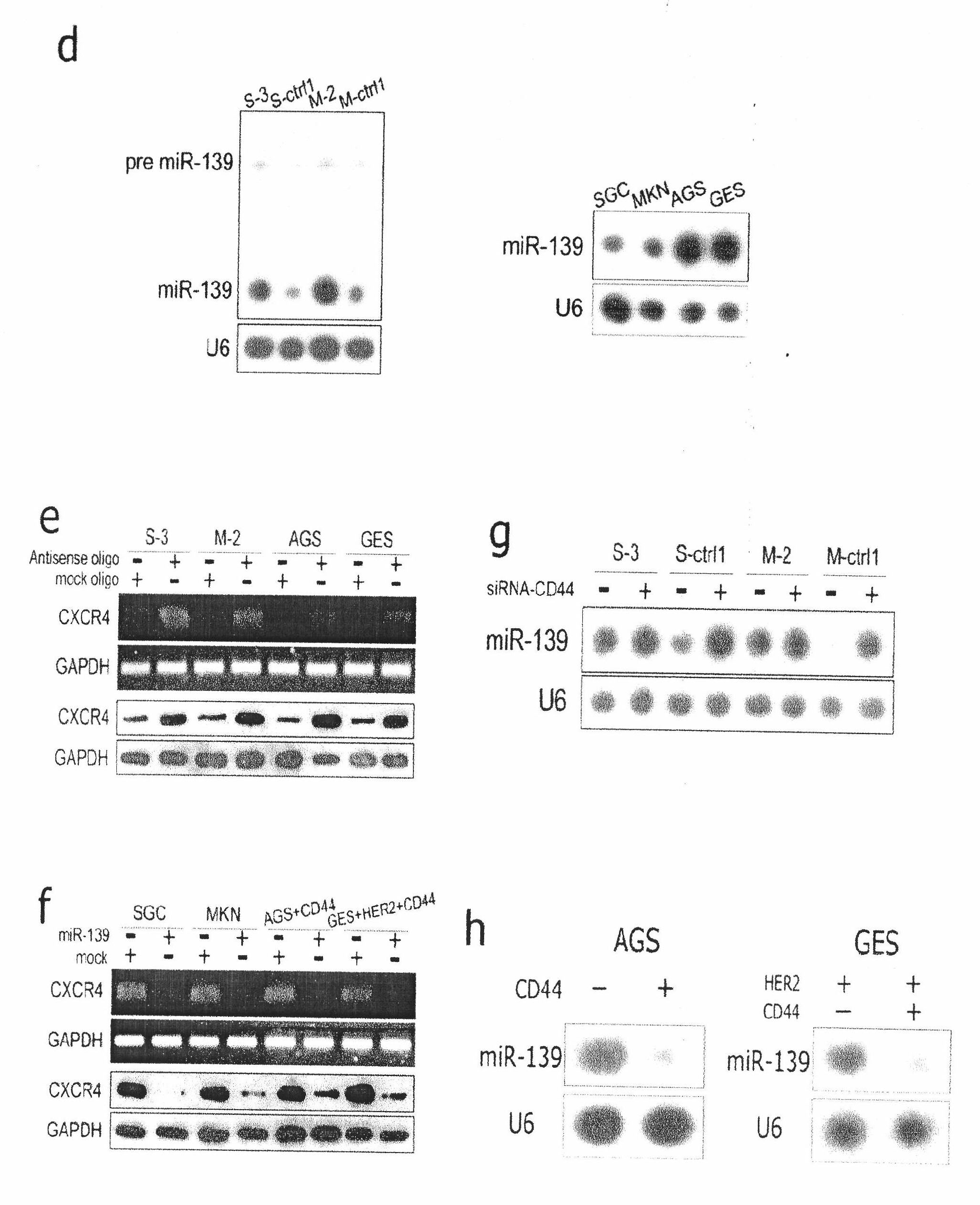 Application of microRNA-139