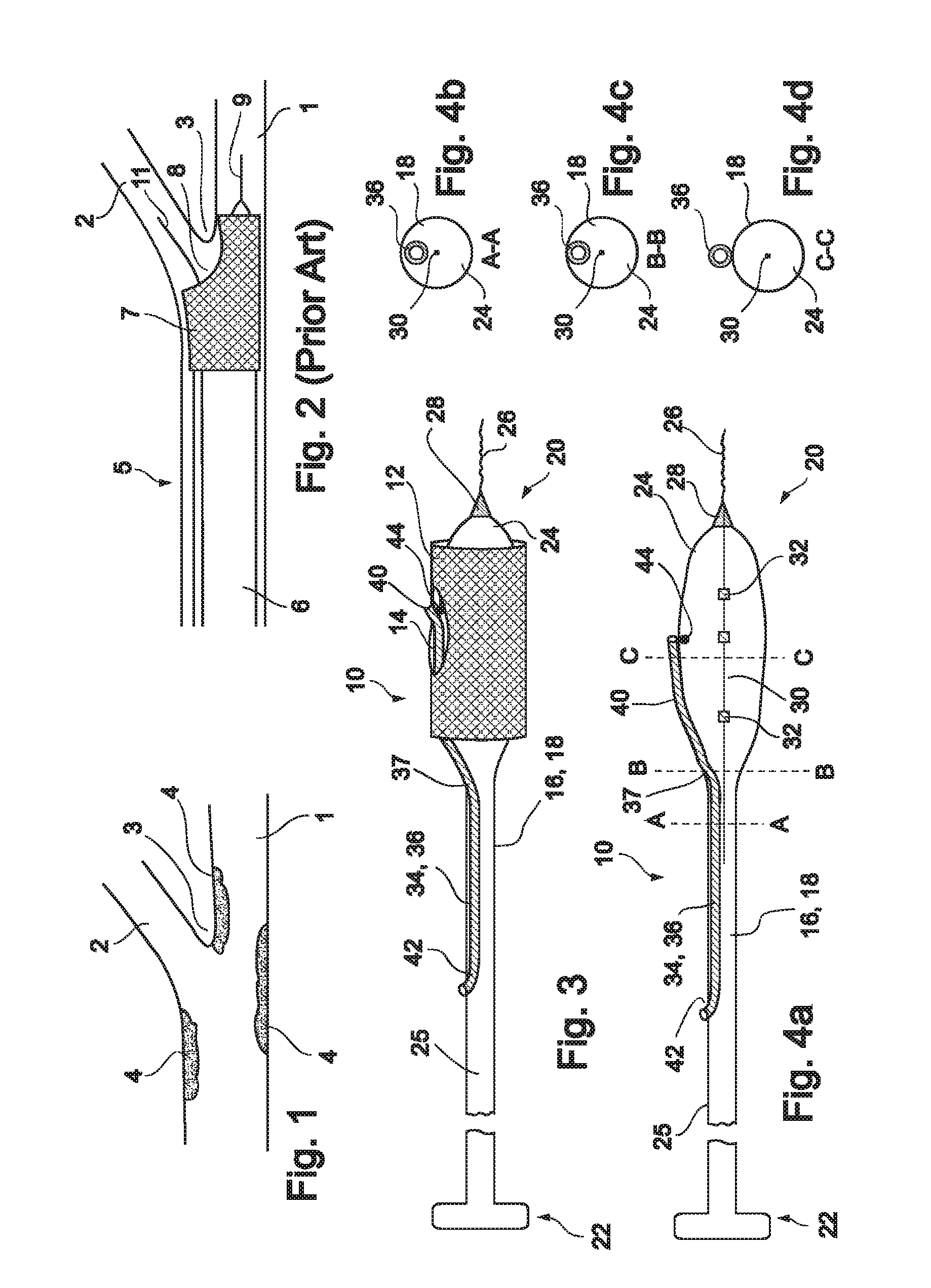 Vessel treatment devices