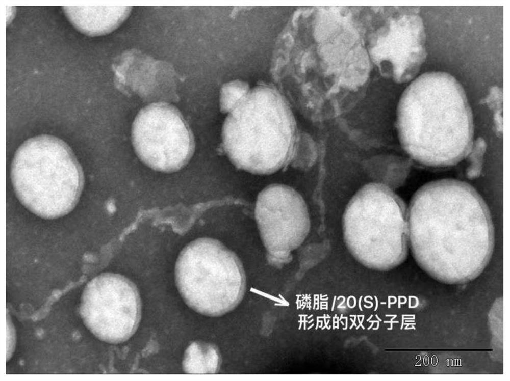 20 (S)-PPD liposome emulsion complex oral administration preparation as well as preparation method and application thereof