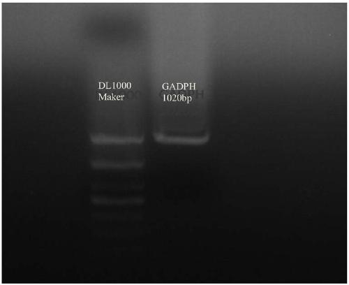Swine cholera attenuated salmonella recombinant strain for expressing haemophilus parasuis GAPDH gene