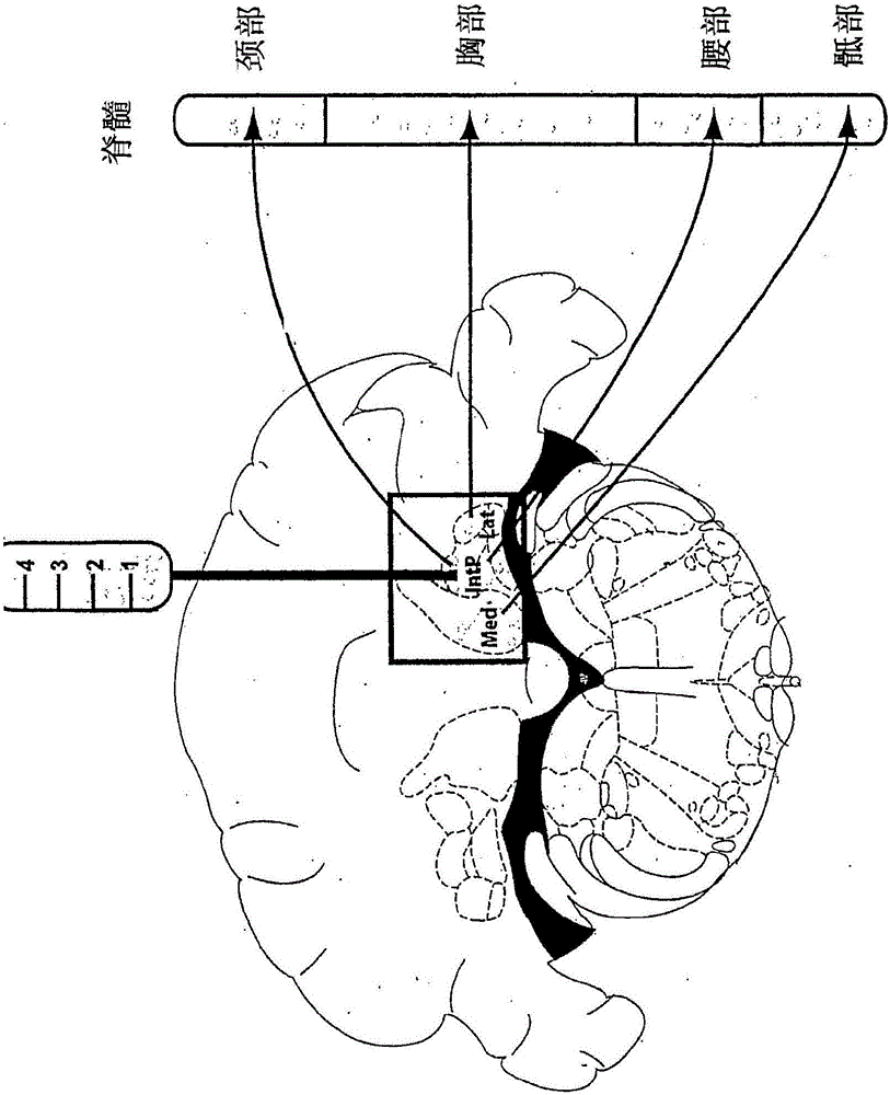 Gene Therapy For Neurometabolic Disorders