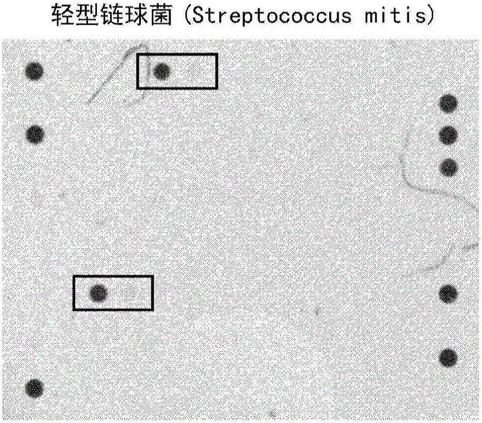 Detection of streptococcus pneumoniae