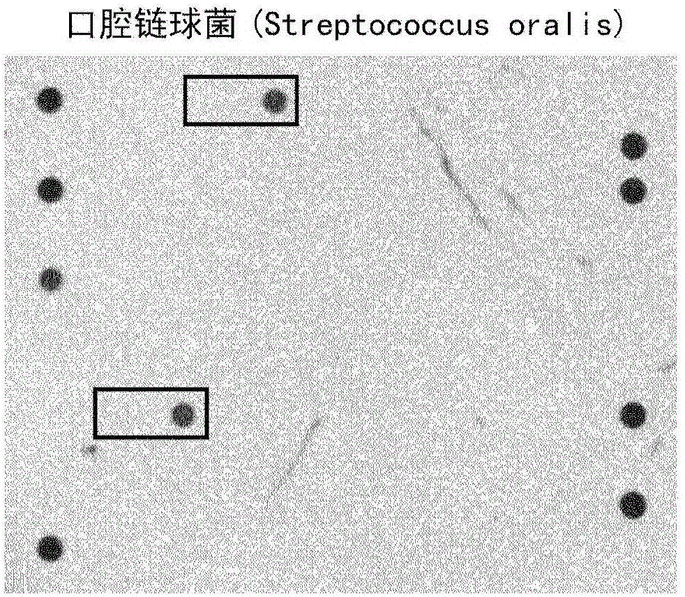 Detection of streptococcus pneumoniae