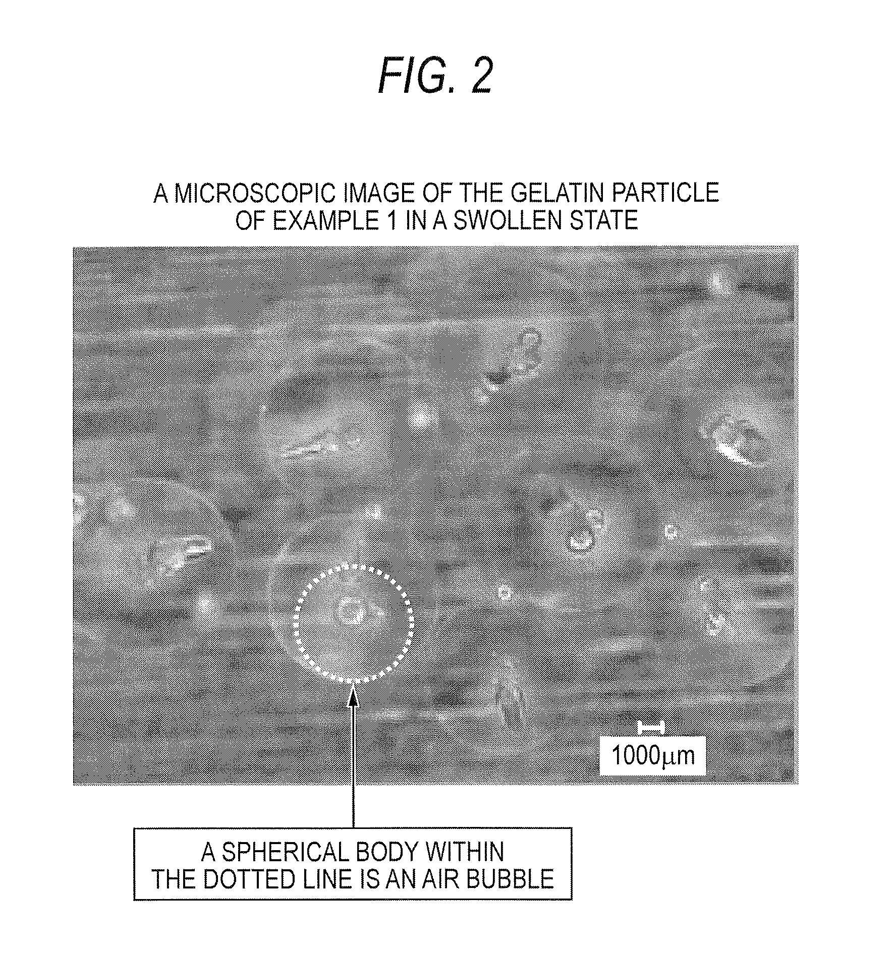 Gelatin particle and use thereof, and device for administration of physiologically active substance