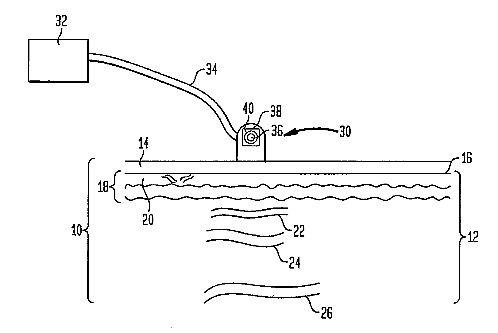 Method And Apparatus For Improved Vascular Related Treatment