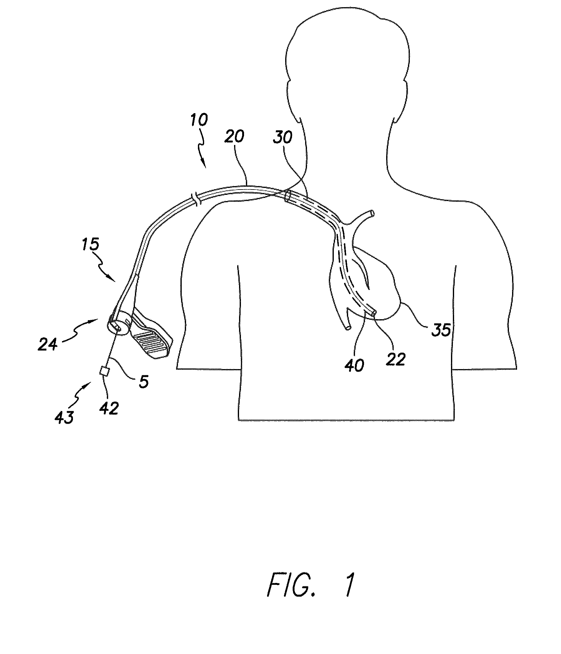 Slittable delivery device assembly for the delivery of a cardiac surgical device