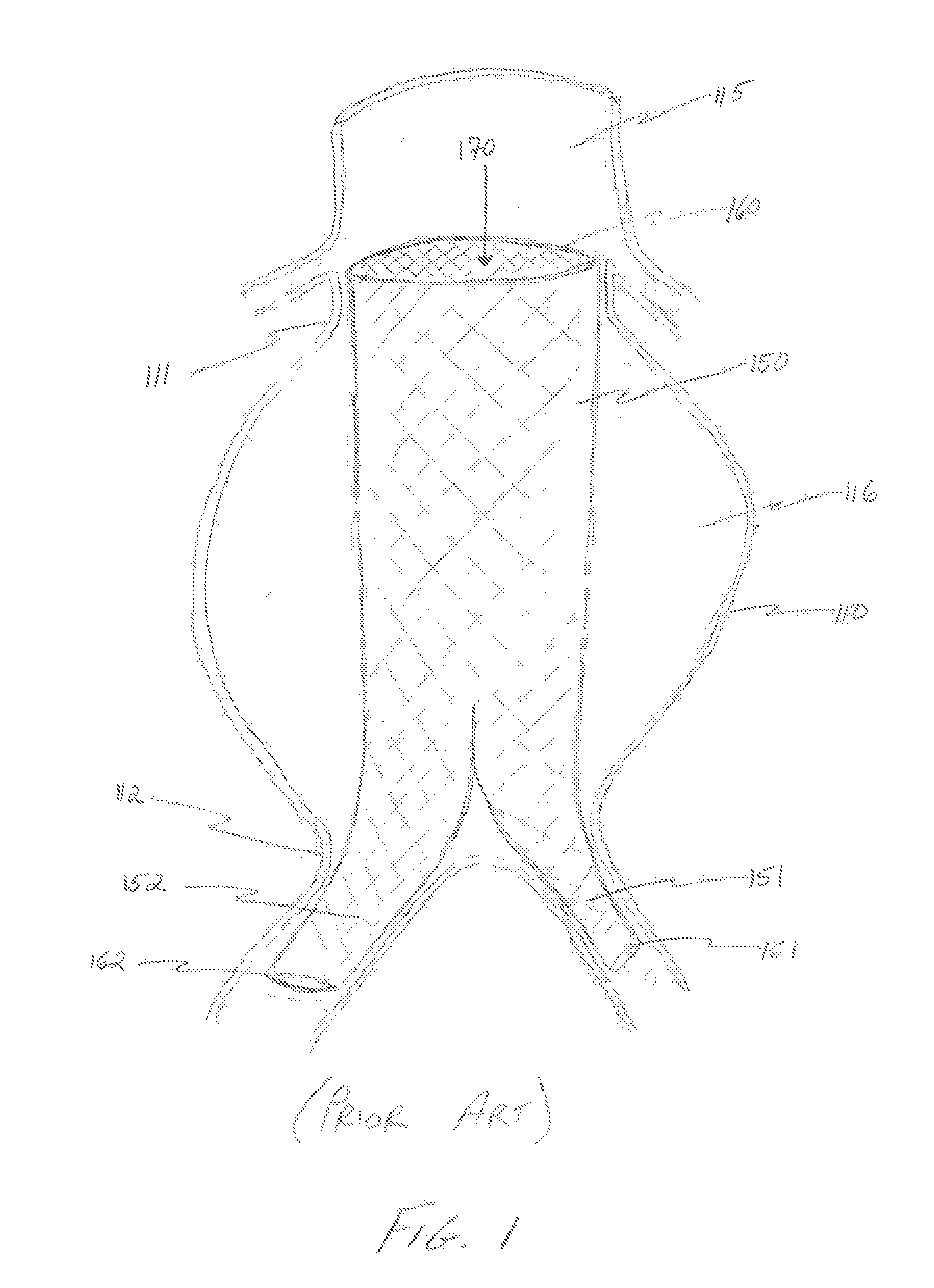 In-Situ Forming Foams for Treatment of Aneurysms