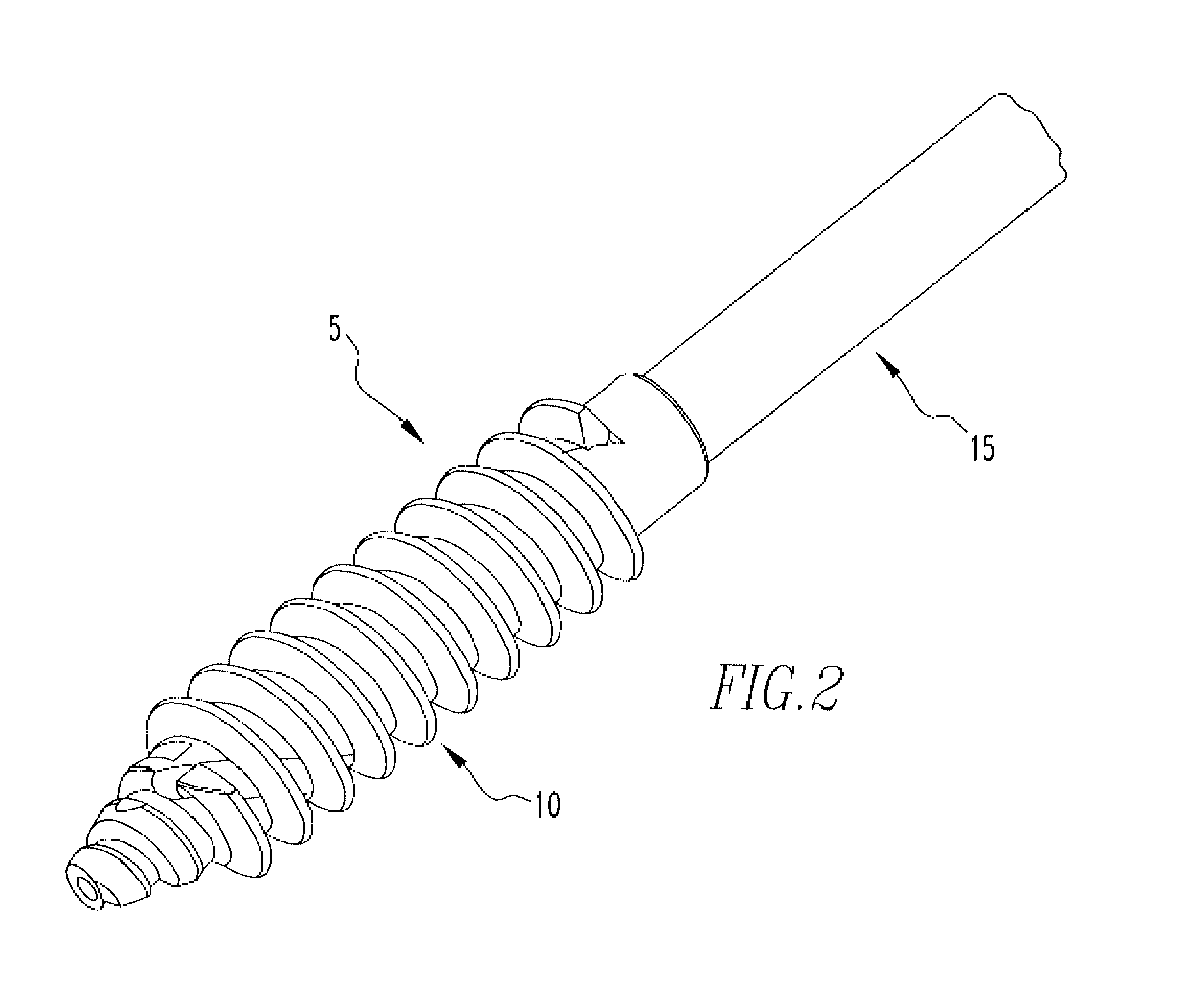 Helicoil interference fixation system for attaching a graft ligament to a bone