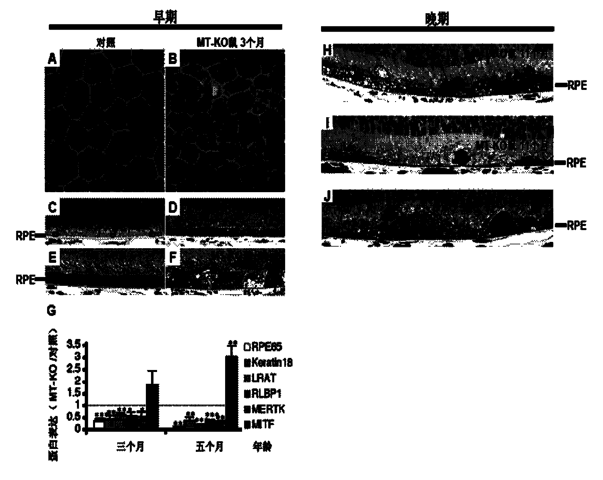 Rapamycin microemulsion injection for eyes and preparation method and application thereof