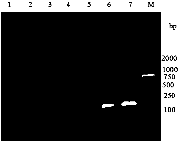 Kit for real-time fluorescence quantitative PCR (Polymerase Chain Reaction) detection of pigeon TTV (Torque teno virus) and novel pigeon adenovirus EvaGreen