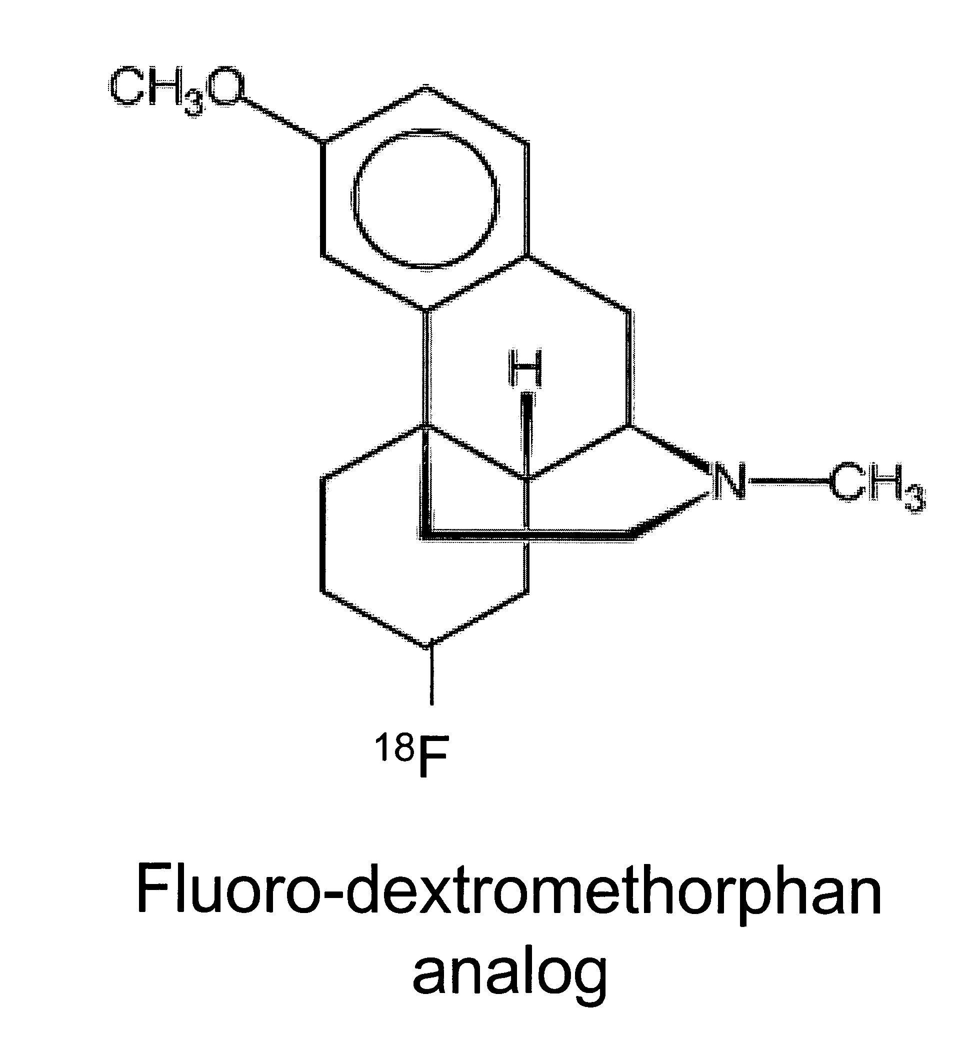 Enhancement of impaired motor and mental functions, using dextromethorphan and oxidase enzyme inhibitor