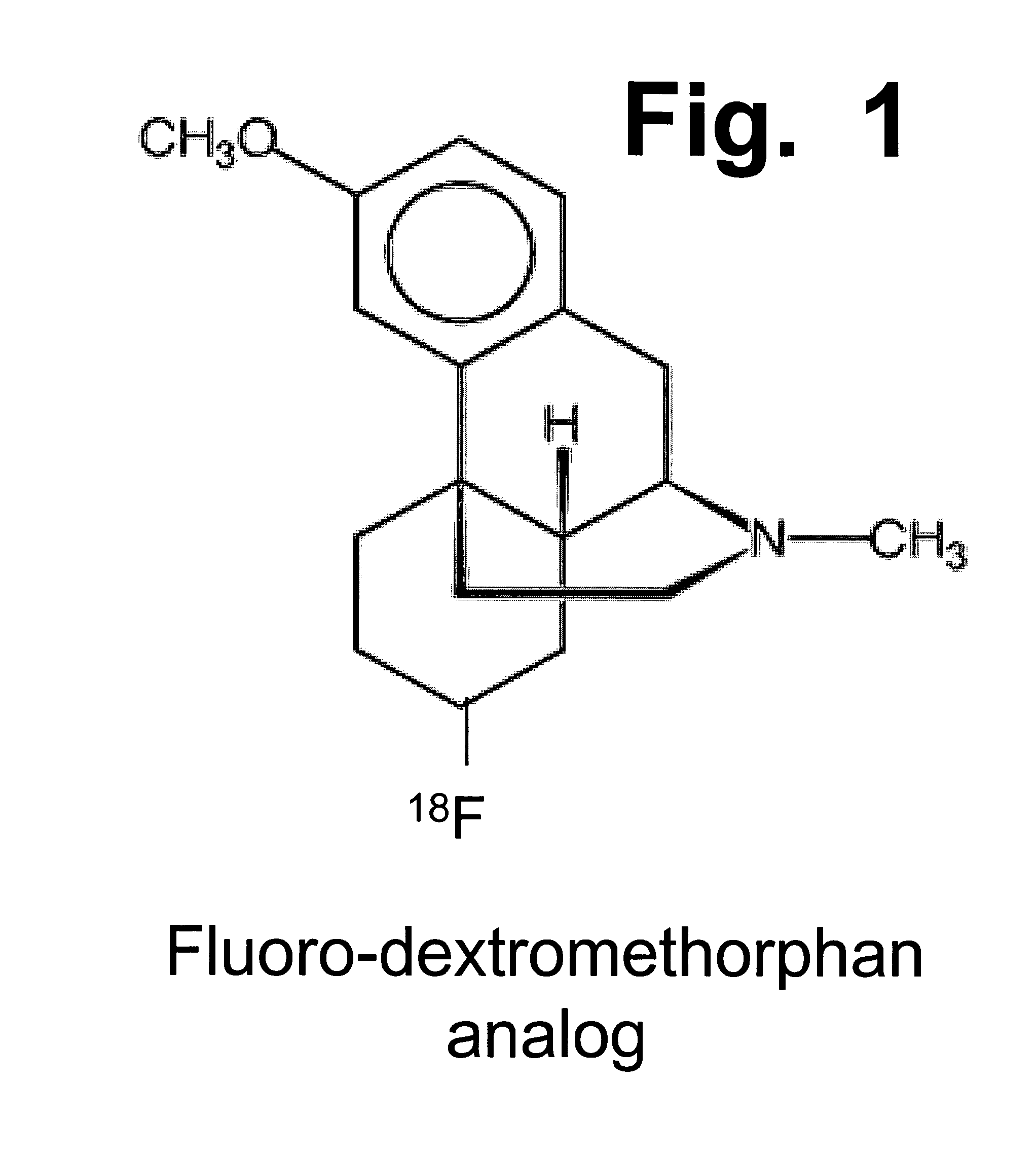 Enhancement of impaired motor and mental functions, using dextromethorphan and oxidase enzyme inhibitor