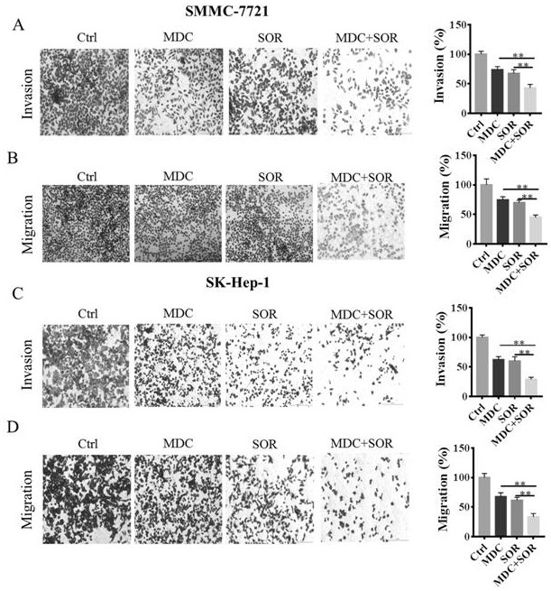 Application of composition of demethylated magnesium cantharidate and sorafenib in preparation of anti-hepatoma drugs