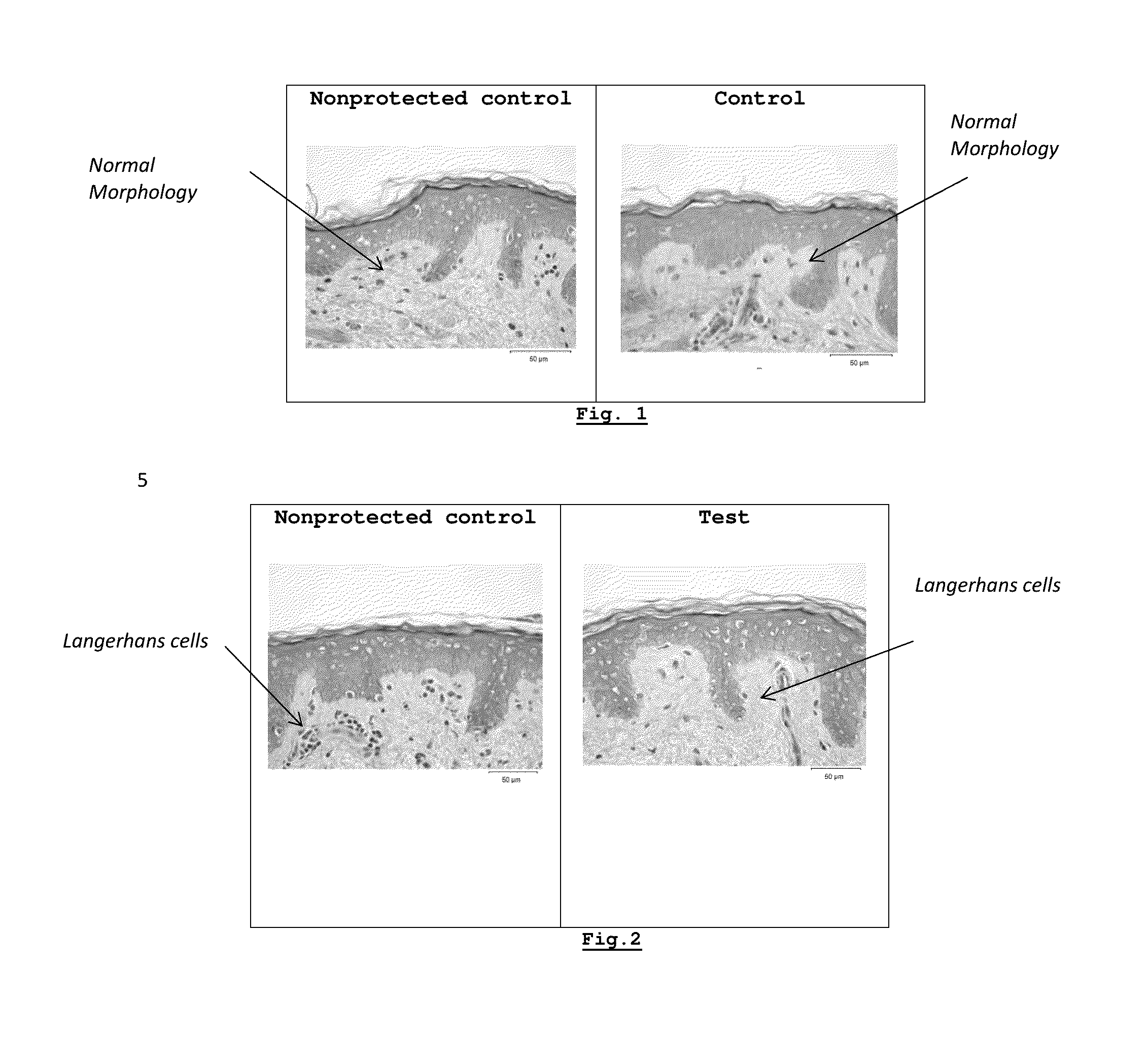 Use of an amphoteric chelating agent for preventing contact allergies