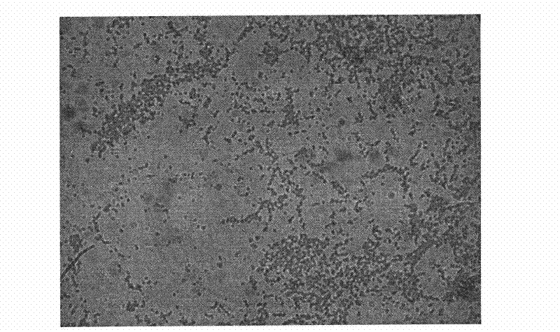 Acinetobacter sp. and application of composite bacterial agent of acinetobacter species