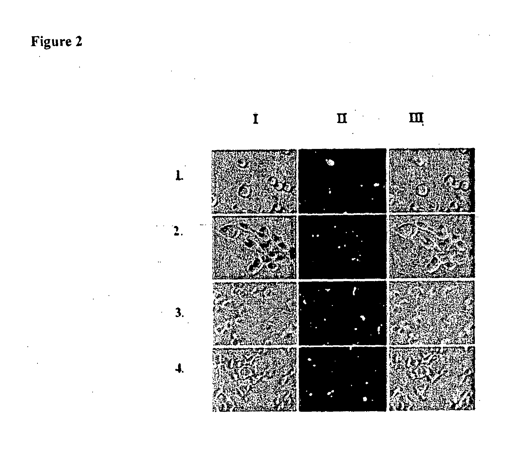 METHOD FOR INHIBITING TUMOR GROWTH THROUGH RNA-INTERFERENCE USING LIPOSOMALLY ASSOCIATED CDC20 siRNA