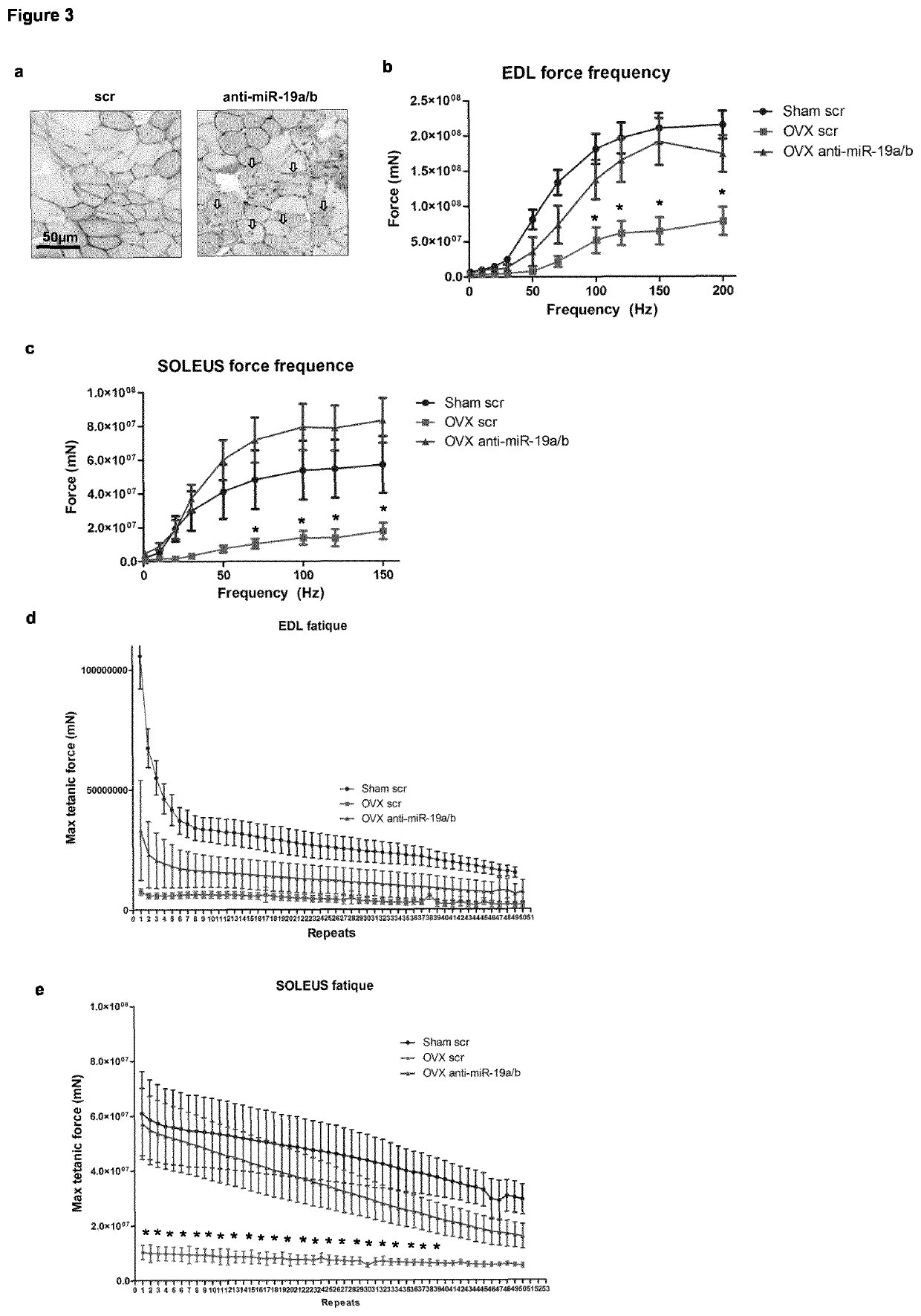 Microrna 19a/19b for use in treating a pathological condition associated with bone loss or reduced muscle function