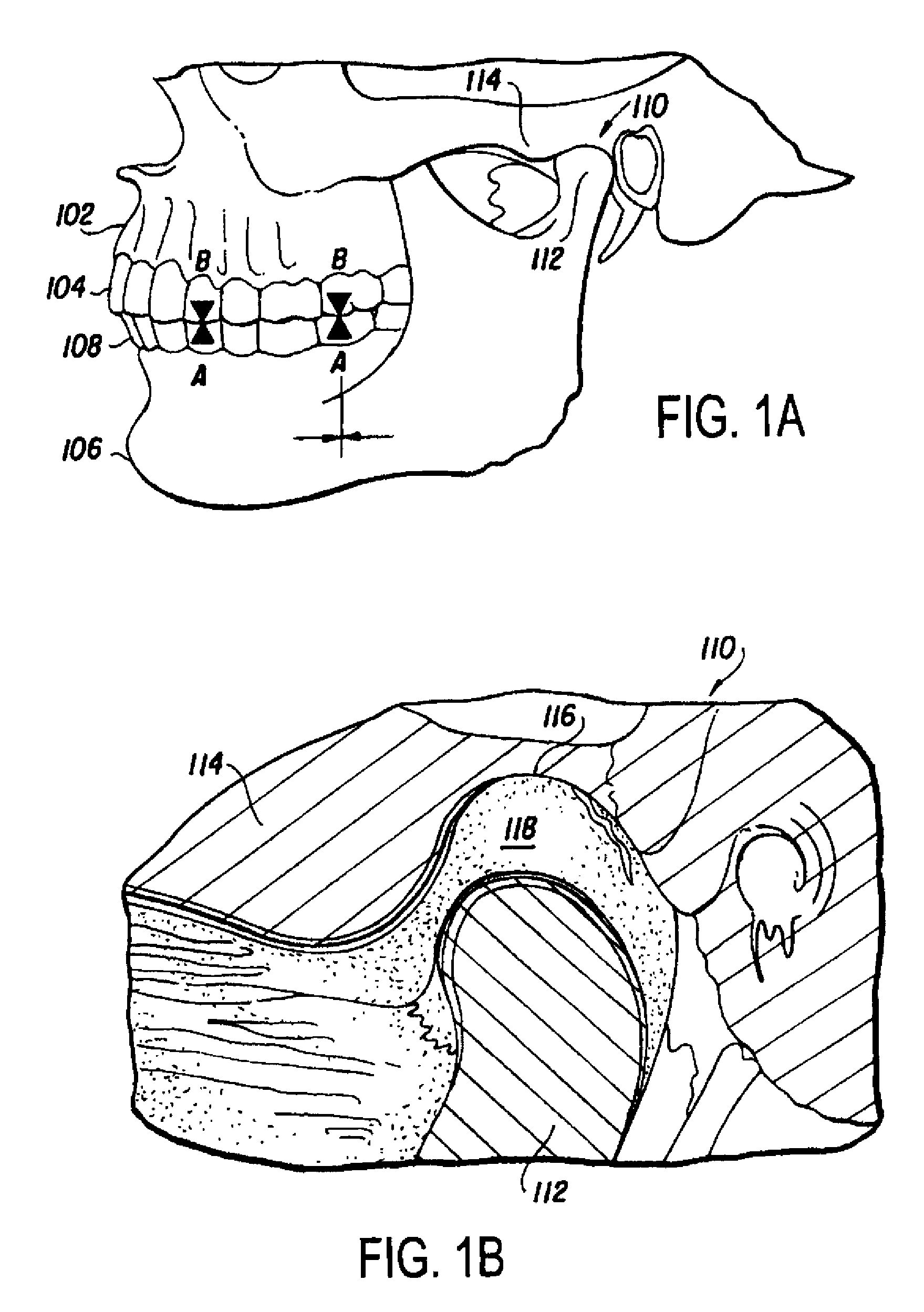 Physical rehabilitation and training aid: method of using musculoskeletal repositioning device