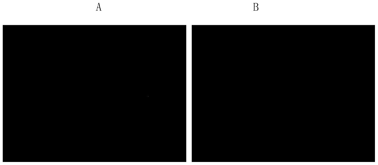 Application of lycium ruthenicum anthocyanin to preparing medicine for inducing apoptosis of two types of cancer cells