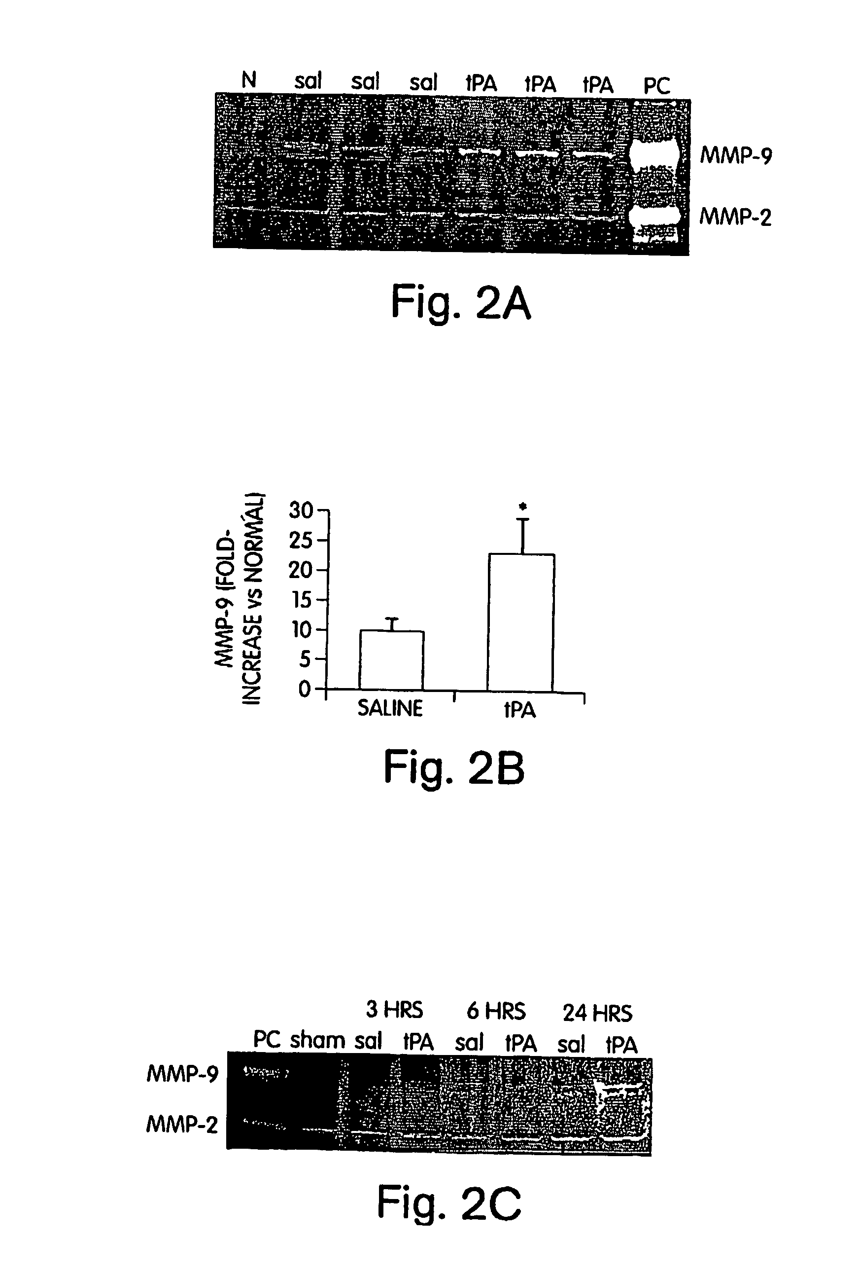 Methods and compositions for protection against thrombolysis associated reperfusion injury