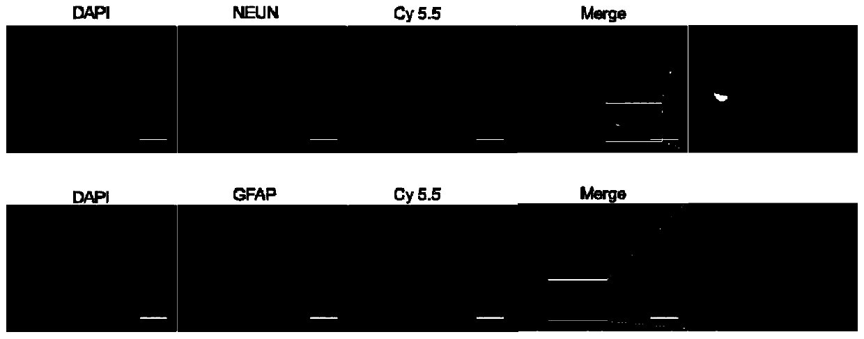 Brain-targeted drug-delivery system, brain-targeted drug, and preparation methods of brain-targeted drug-delivery system and brain-targeted drug