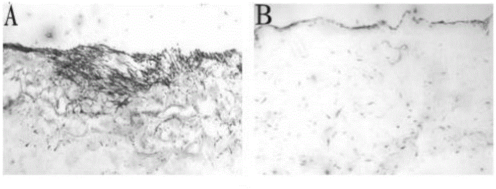 Tissue engineering skin and application thereof