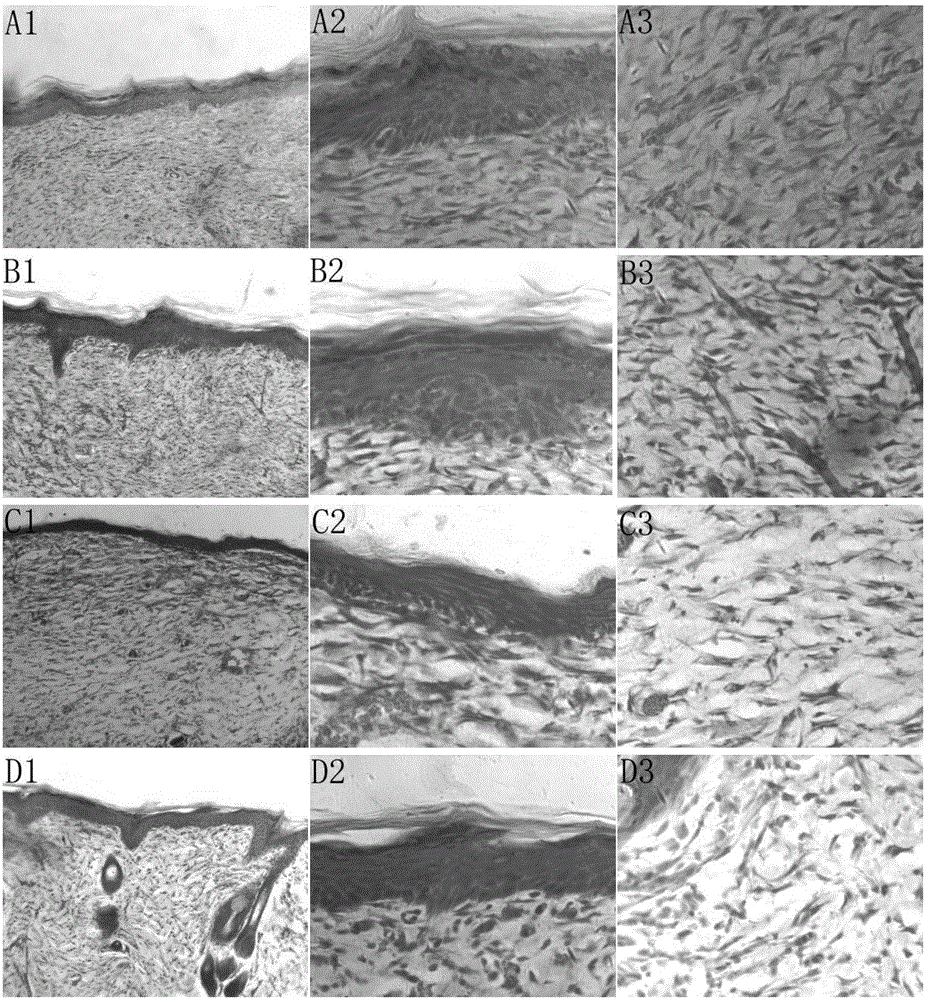 Tissue engineering skin and application thereof