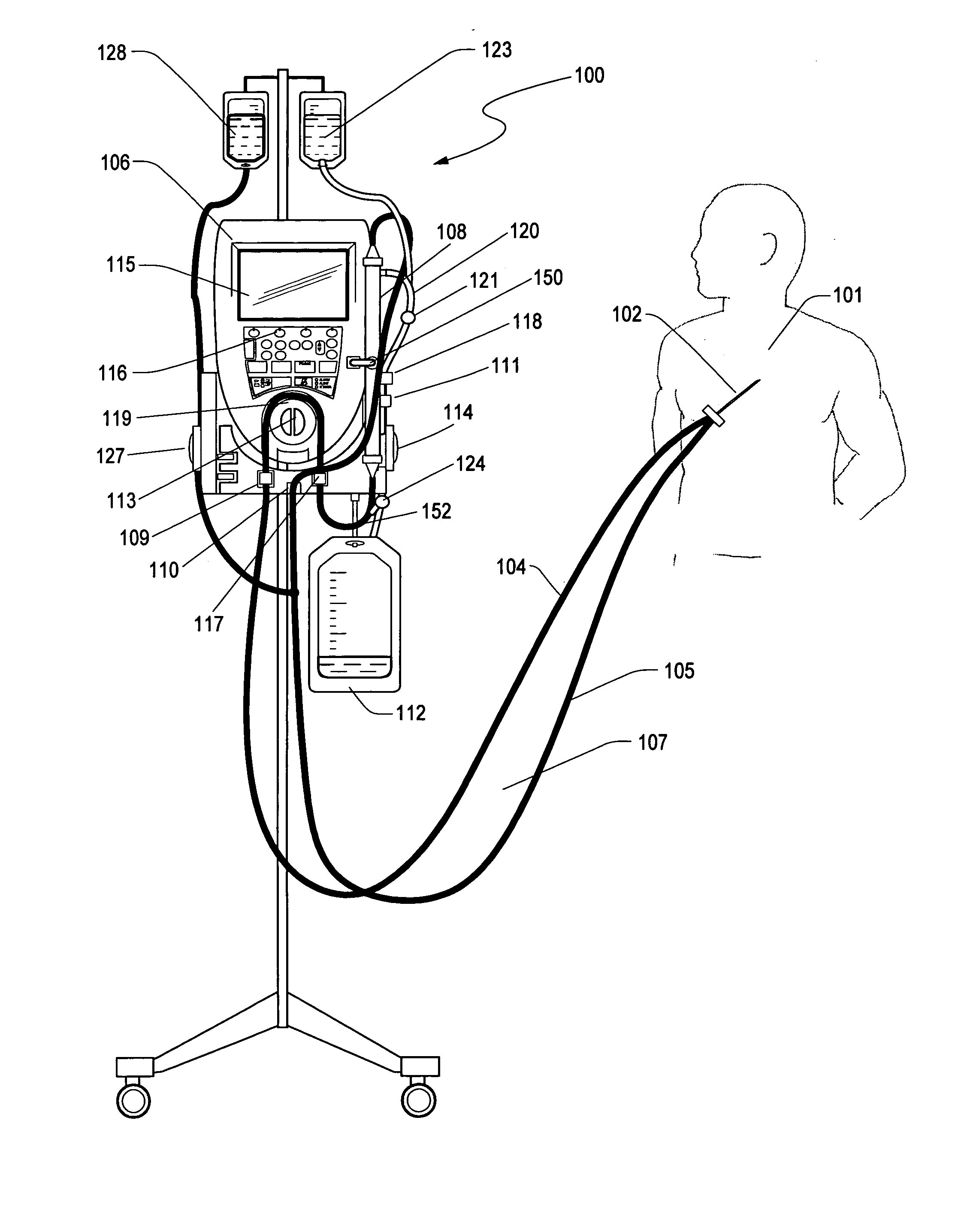Method and apparatus for an extracorporeal control of blood glucose