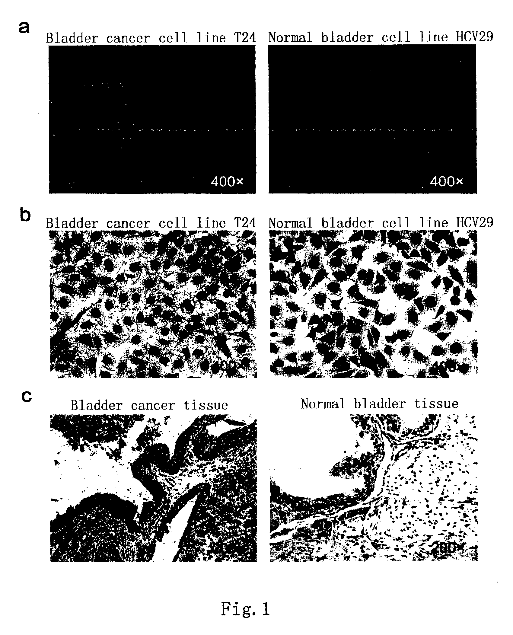 Bladder cancer tumor marker, antibody and use thereof