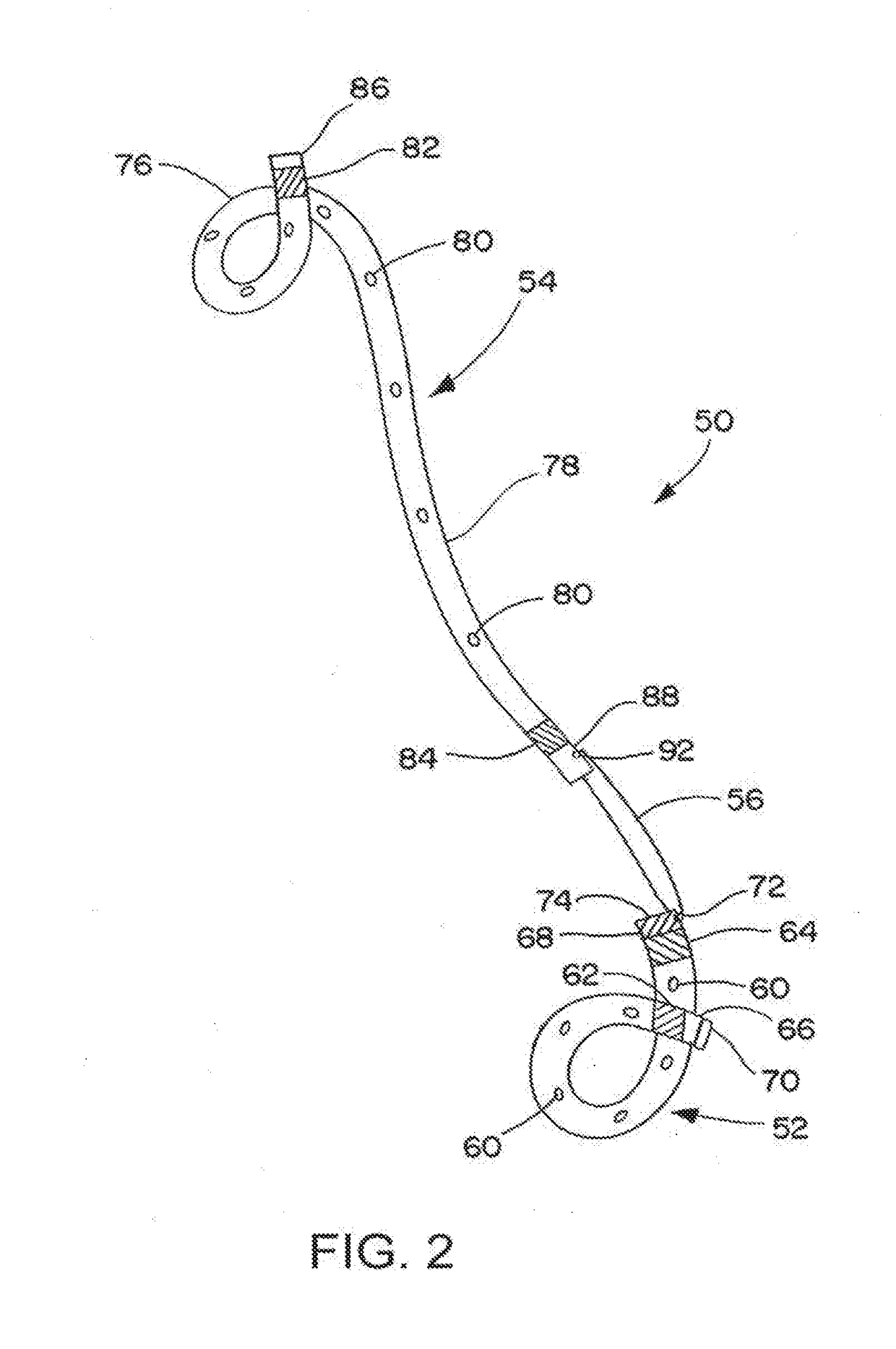 Ureteral stent for placement in a kidney and bladder