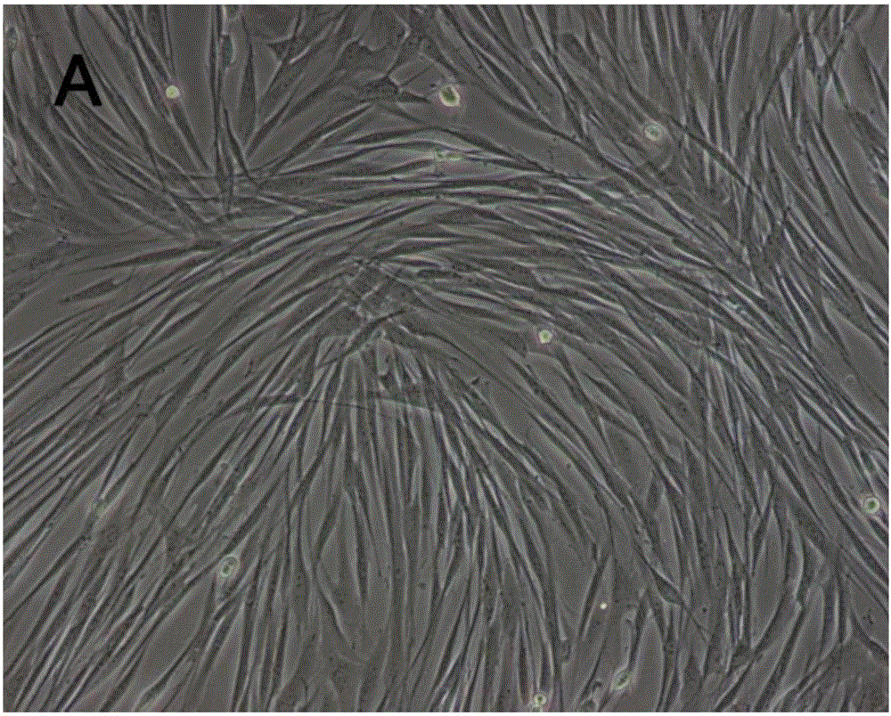 Acellular matrix material based on adipose-derived stem cell sheet and preparation method of acellular matrix material