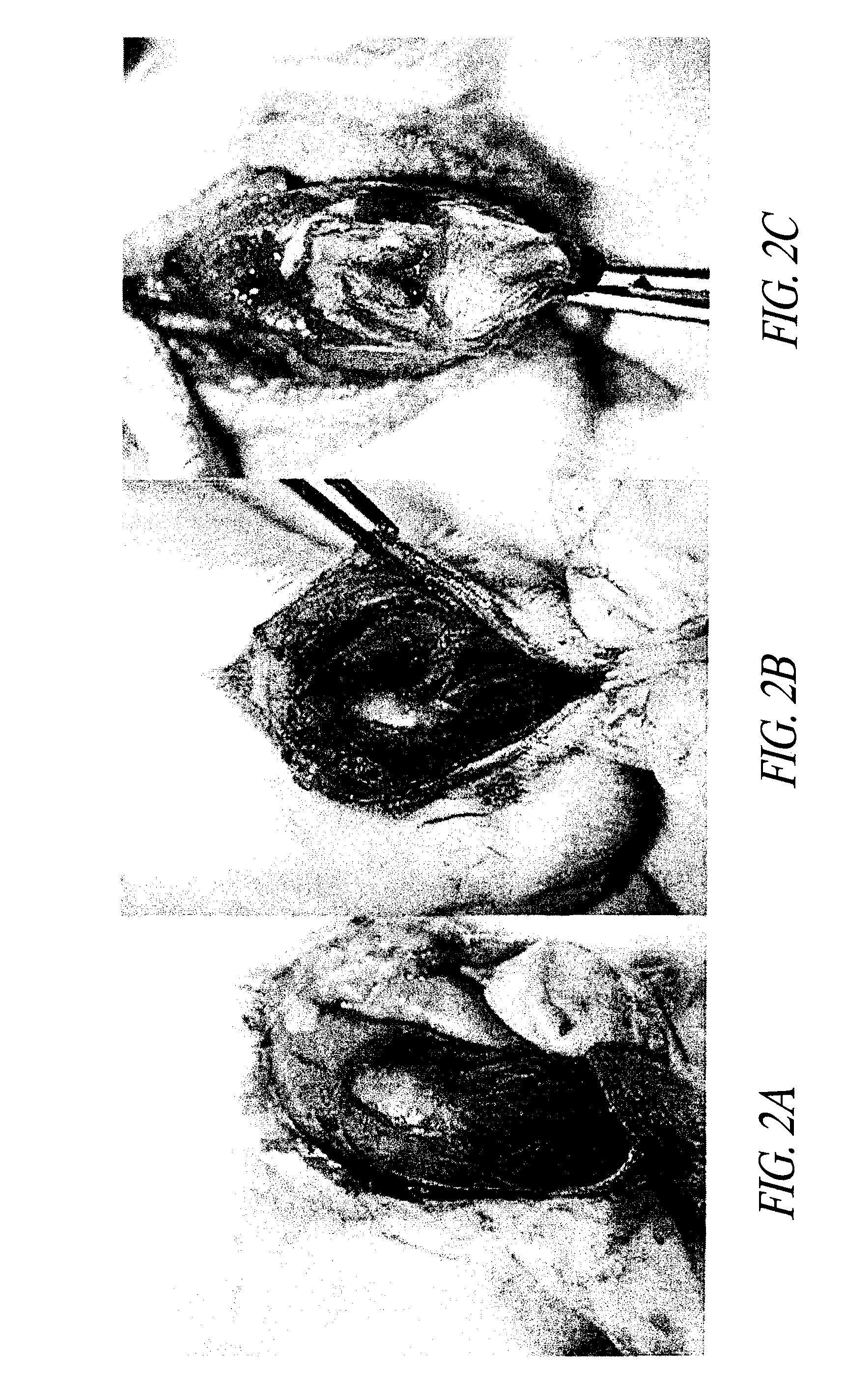 Compositions and methods for treating contracture