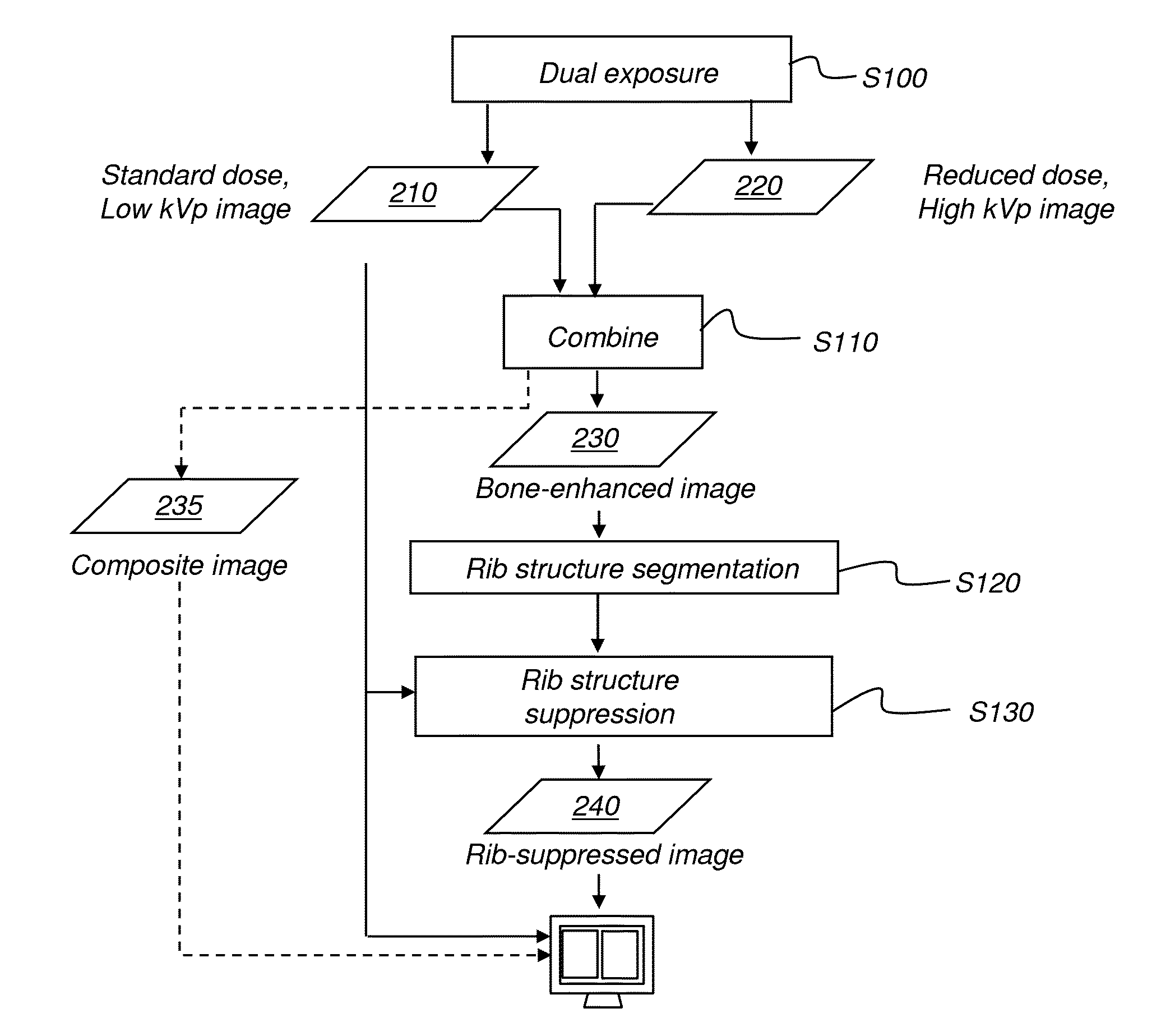 Hybrid dual energy imaging and bone suppression processing