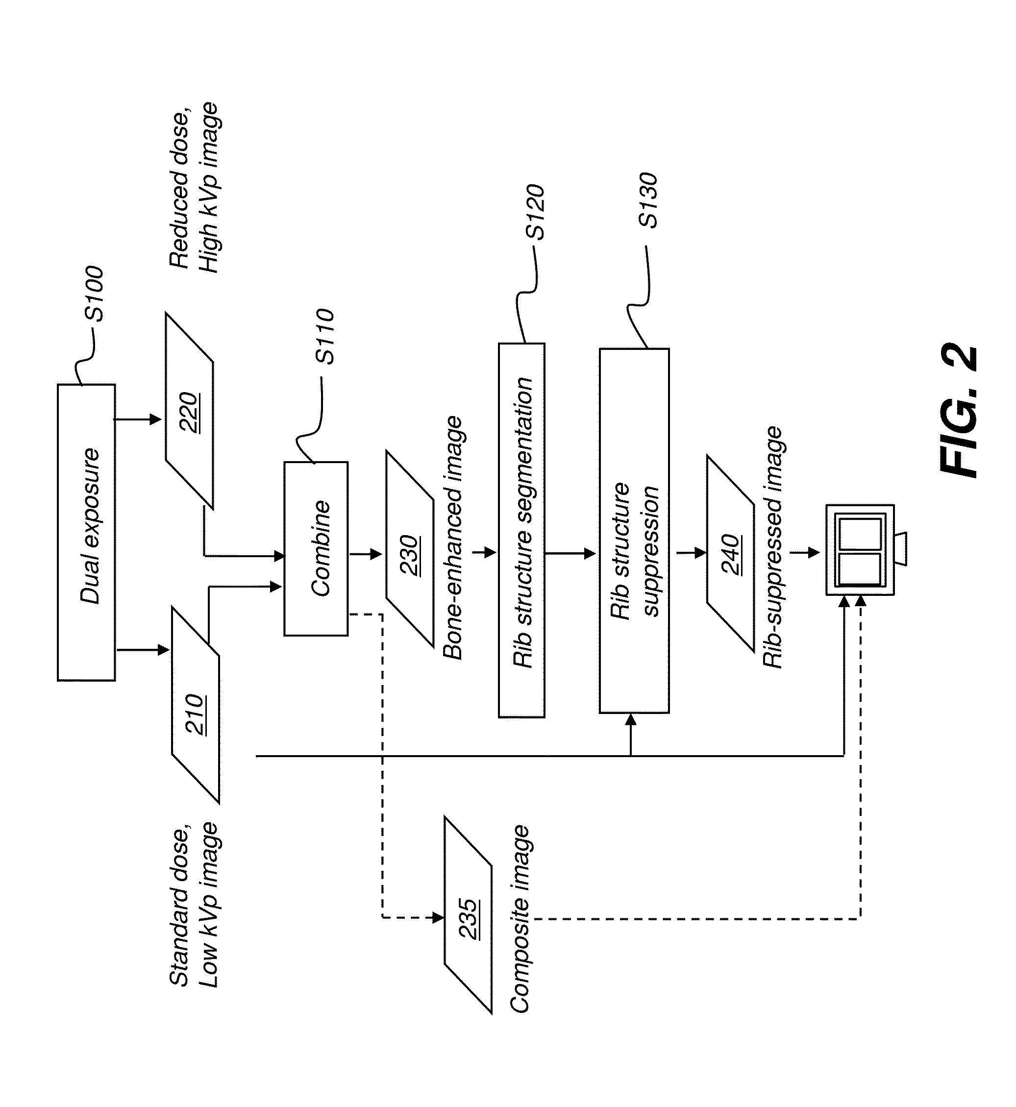 Hybrid dual energy imaging and bone suppression processing