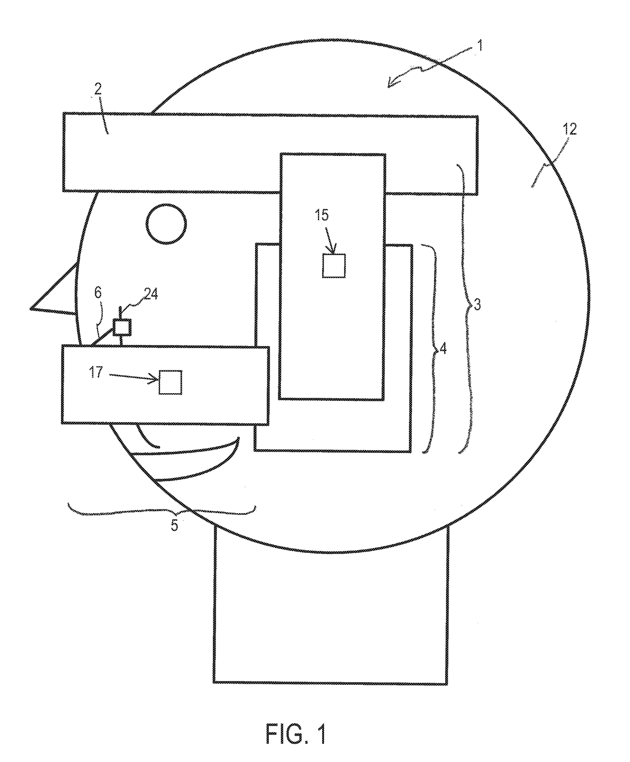 Craniofacial External Distraction Apparatus