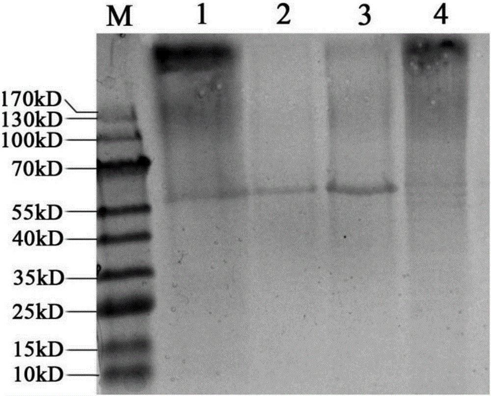 rBCG for expression of Br. Melitensis P39 and L7/L12 fusion gene and construction method thereof