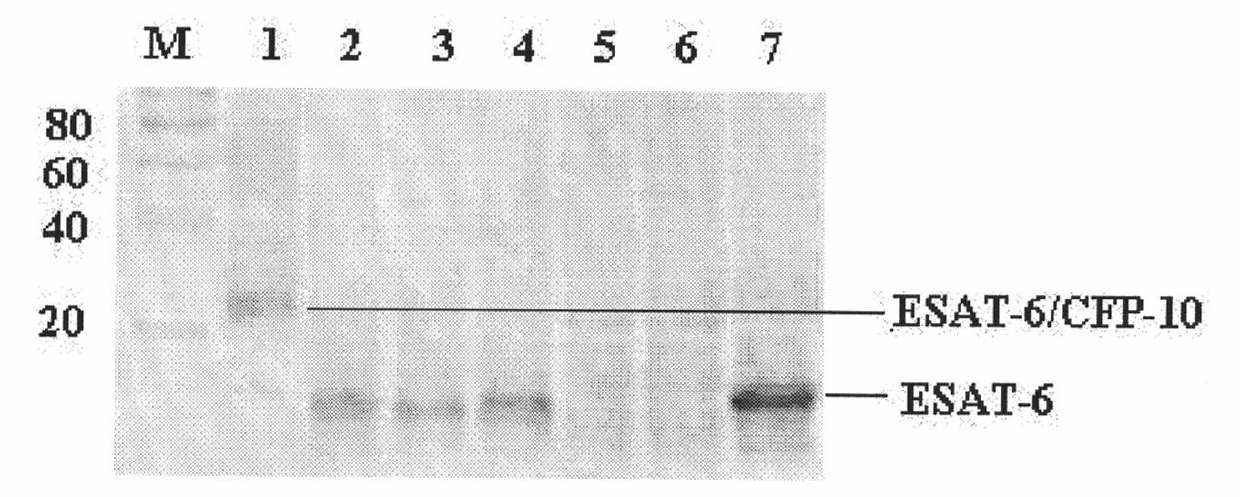 Monoclonal antibody TBEF3 of tubercle bacillus-resistant ESAT-6 and application thereof