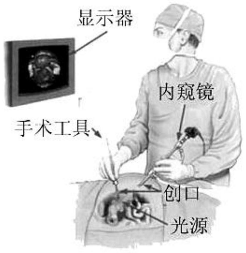 A method for generating patient body surface projection image sequences