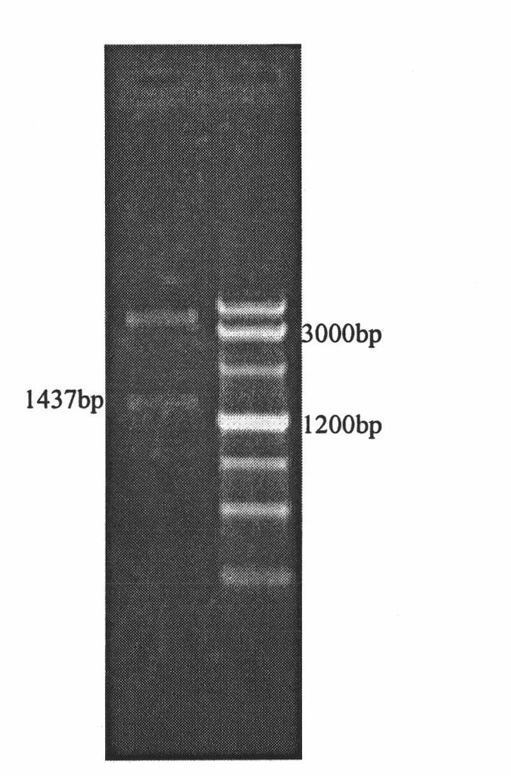 Method for screening effective shRNA of lipoprotein lipase gene