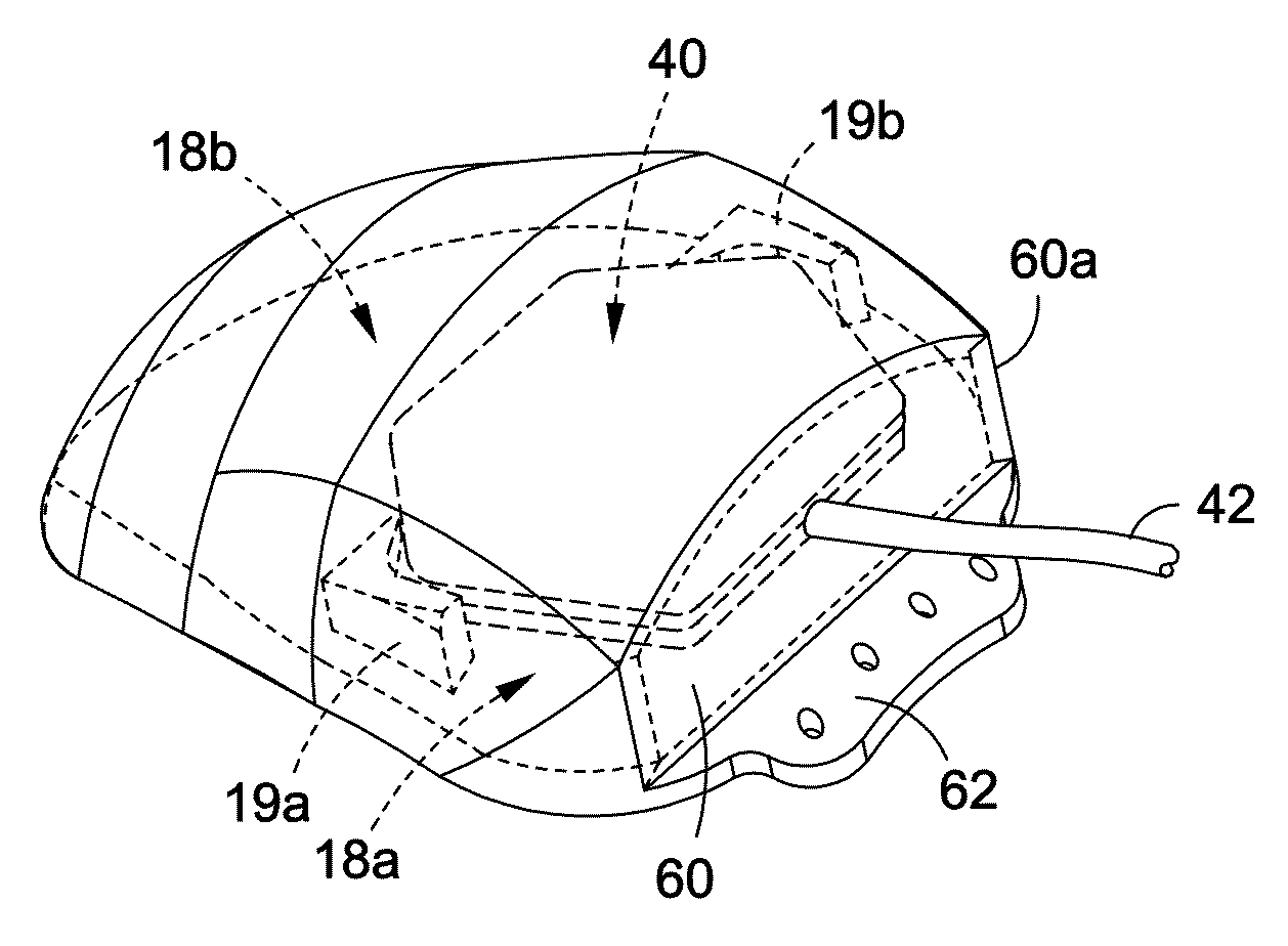 Implantable medical assembly and methods