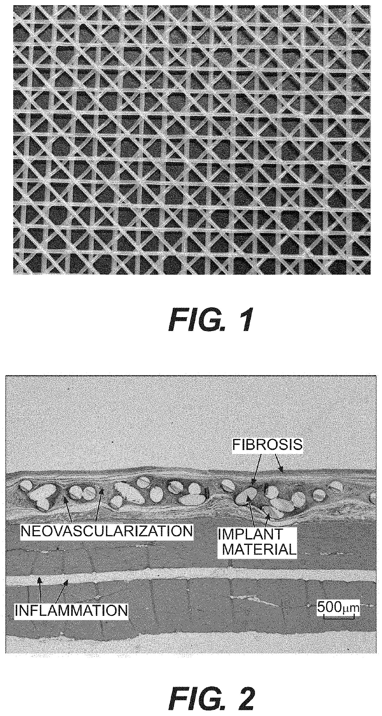 Medical devices containing poly(butylene succinate) and copolymers thereof