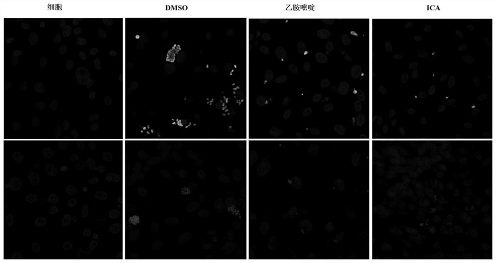 Application of aminothiazole compounds in preparation of medicine for treating toxoplasma gondii infection diseases