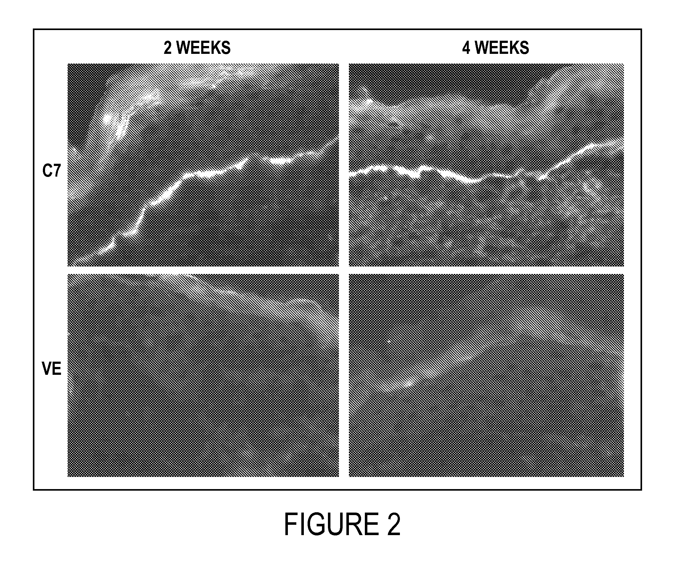 Composition and Method for Healing of Skin Wounds