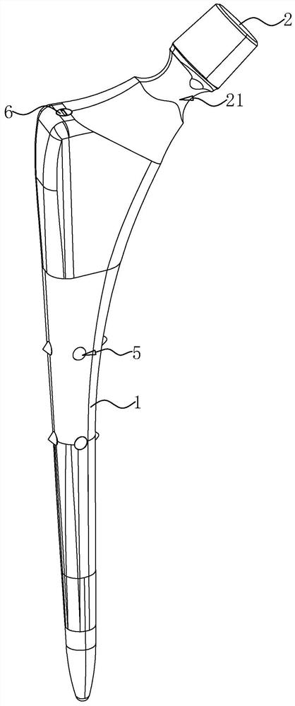 Anti-loosening femoral stem prosthesis