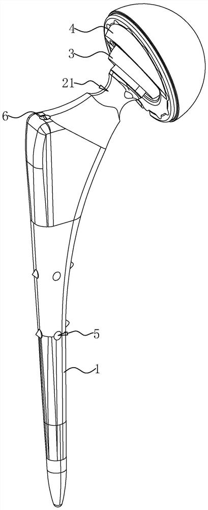 Anti-loosening femoral stem prosthesis