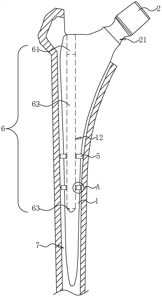 Anti-loosening femoral stem prosthesis