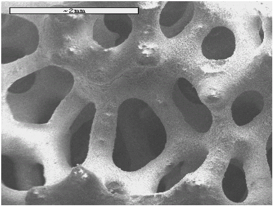 Foam silicon carbide based structured catalyst and application in preparation of butadiene