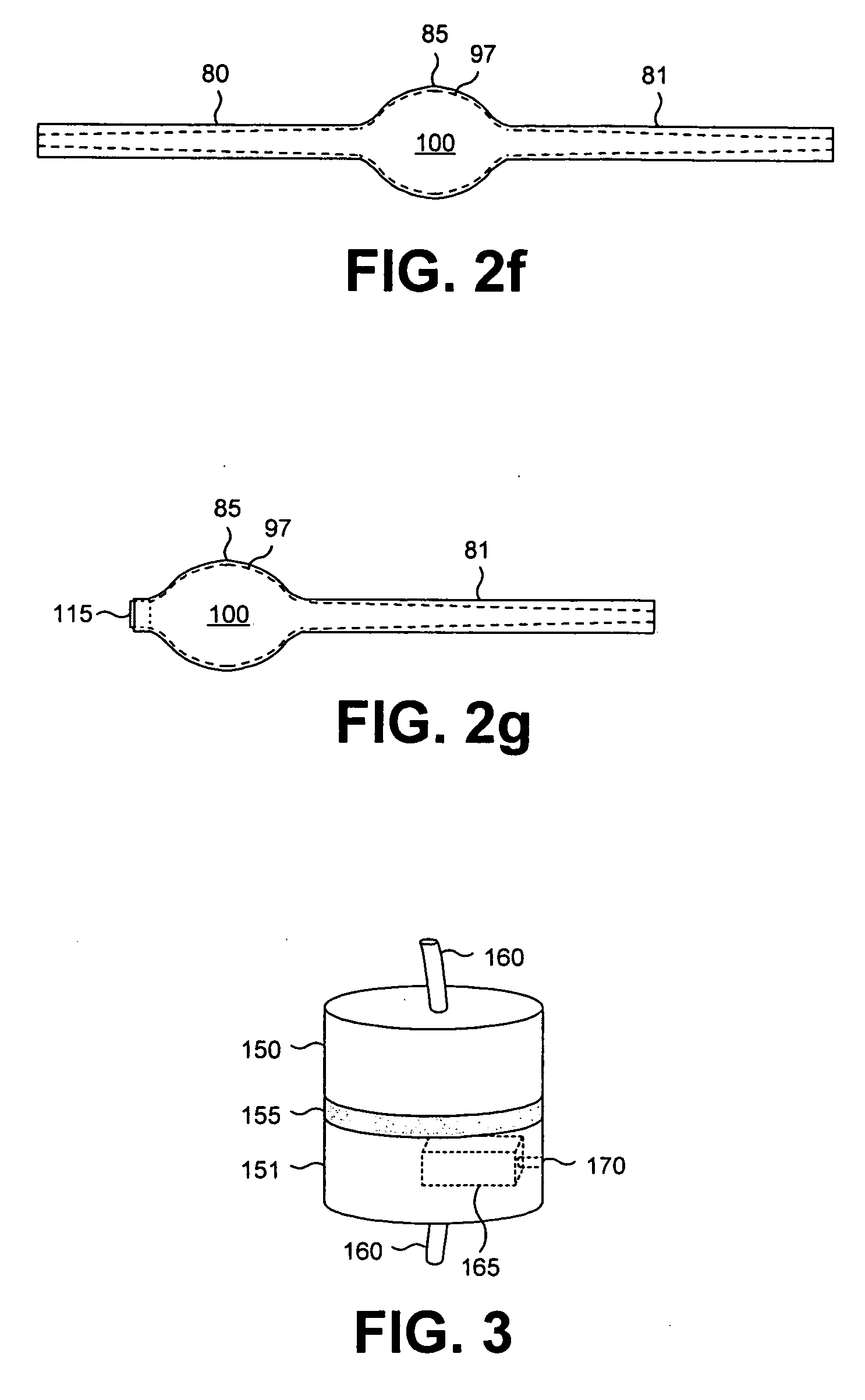 Resorbable hollow devices for implantation and delivery of therapeutic agents