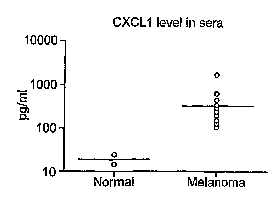 Biomarkers for Melanoma